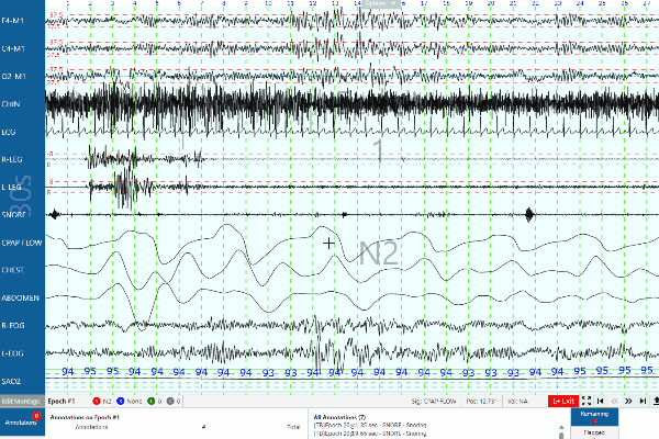Isr Sync Example Sleep ISR_Help